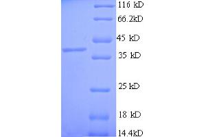 SDS-PAGE (SDS) image for Carboxypeptidase A3 (Mast Cell) (CPA3) (AA 110-417) protein (His tag) (ABIN5709315)