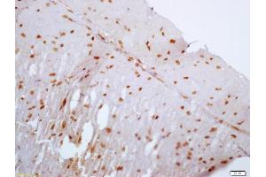 Formalin-fixed and paraffin embedded rat heart labeled with Anti-FAM129A Polyclonal Antibody, Unconjugated (ABIN717701) at 1:200 followed by conjugation to the secondary antibody and DAB staining