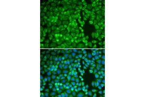 Immunofluorescence analysis of A549 cells using IDE antibody (ABIN5970800). (IDE anticorps)