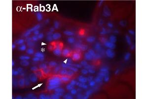 Indirect immunolabeling of methanol/DMSO fixed zebrafish glomerulus. (RAB3A anticorps  (AA 2-14))