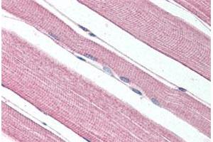 Immunohistochemical staining of human skeletal muscle with PROKR1 polyclonal antibody . (Prokineticin Receptor 1 anticorps  (N-Term))