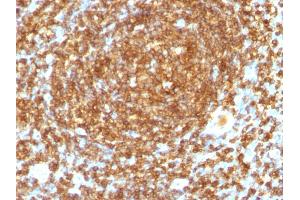 Formalin-fixed, paraffin-embedded human Tonsil stained with CD45RB Monoclonal Antibody (PTPRC/1132). (CD45 anticorps)