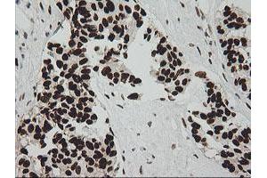 Image no. 8 for anti-Zinc Finger and SCAN Domain Containing 18 (ZSCAN18) antibody (ABIN1501857) (ZSCAN18 anticorps)