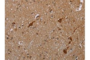 The image is immunohistochemistry of paraffin-embedded human brain tissue using ABIN7190062(CASP8AP2 Antibody) at dilution 1/20. (FLASH anticorps)