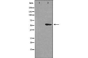Western blot analysis of extracts from HUVEC cells using CEP55 antibody.