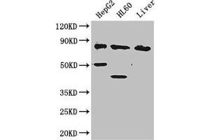 Western Blot Positive WB detected in: HepG2 whole cell lysate, HL60 whole cell lysate, Mouse liver tissue All lanes: PFKL antibody at 2. (PFKL anticorps  (AA 229-479))