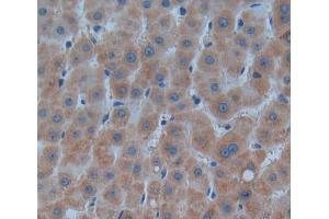 Used in DAB staining on fromalin fixed paraffin- embedded liver tissue