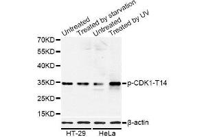 Western blot analysis of extracts of HT-29 and HeLa cells, using Phospho-CDK1-T14 antibody. (CDK1 anticorps  (pThr14))