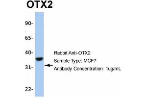 Host:  Rabbit  Target Name:  OTX2  Sample Type:  MCF7  Antibody Dilution:  1. (OTX2 anticorps  (N-Term))
