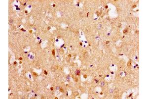 Immunohistochemistry of paraffin-embedded human brain tissue using ABIN7171992 at dilution of 1:100 (TPMT anticorps  (AA 4-244))