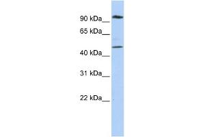 WB Suggested Anti-MARCH4 Antibody Titration:  0. (MARCH4 anticorps  (N-Term))