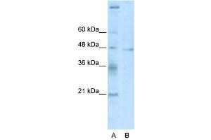 WB Suggested Anti-TSG101  Antibody Titration: 2. (TSG101 anticorps  (C-Term))