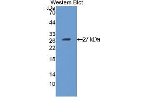 Western blot analysis of the recombinant protein. (ANGPTL1 anticorps  (AA 270-490))