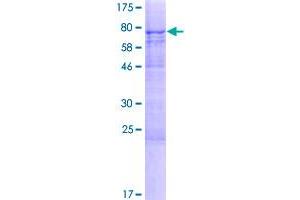 Image no. 1 for Methyltransferase Like 14 (METTL14) (AA 1-456) protein (GST tag) (ABIN1308630)