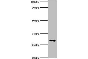 Western blot All lanes: Alpha-ketoglutarate-dependent dioxygenase alkB homolog 2 antibody at 2 μg/mL + Hela whole cell lysate Secondary Goat polyclonal to rabbit IgG at 1/10000 dilution Predicted band size: 30, 18 kDa Observed band size: 30 kDa (ALKBH2 anticorps  (AA 1-261))