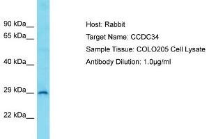 Host: Rabbit Target Name: CCDC34 Sample Type: COLO205 Whole Cell lysates Antibody Dilution: 1. (CCDC34 anticorps  (C-Term))