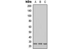 Western blot analysis of RAB41 expression in HEK293T (A), Raw264. (RAB41 anticorps  (Center))