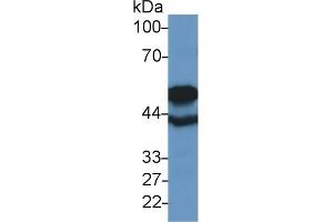 Detection of TUBb6 in Rat Cerebrum lysate using Polyclonal Antibody to Tubulin Beta 6 (TUBb6)