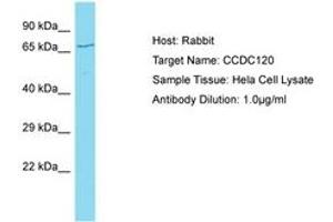 Image no. 1 for anti-Coiled-Coil Domain Containing 120 (CCDC120) (AA 329-378) antibody (ABIN6750717) (CCDC120 anticorps  (AA 329-378))