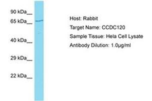 CCDC120 Antikörper  (AA 329-378)