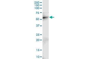 Immunoprecipitation of RAD18 transfected lysate using anti-RAD18 MaxPab rabbit polyclonal antibody and Protein A Magnetic Bead , and immunoblotted with RAD18 purified MaxPab mouse polyclonal antibody (B01P) .