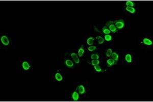 Immunofluorescent analysis of MCF-7 cells (sodium butyrate, 30 mM, 4h) using ABIN7139177 at dilution of 1:100 and Alexa Fluor 488-congugated AffiniPure Goat Anti-Rabbit IgG(H+L)