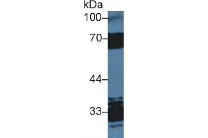 Detection of HCII in Human Serum using Polyclonal Antibody to Heparin Cofactor II (HCII)