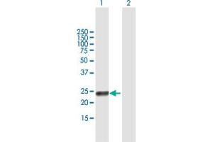 Western Blot analysis of RAET1G expression in transfected 293T cell line by RAET1G MaxPab polyclonal antibody. (Retinoic Acid Early Transcript 1G (RAET1G) (AA 1-213) anticorps)