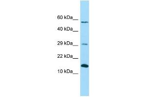 WB Suggested Anti-NDUFB4 Antibody Titration: 1.