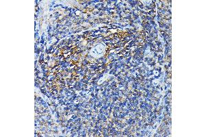 Immunohistochemistry of paraffin-embedded rat spleen using PRC1 Rabbit pAb (ABIN6128502, ABIN6146124, ABIN6146125 and ABIN6222808) at dilution of 1:100 (40x lens).