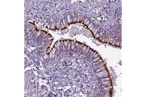 Immunohistochemical staining of human bronchus with CD99L2 polyclonal antibody  shows strong membranous positivity in respiratory epithelial cells. (CD99L2 anticorps)