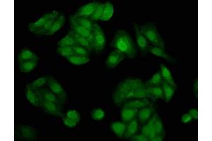 Immunofluorescence staining of HepG2 cells with ABIN7143530 at 1:200, counter-stained with DAPI. (NUDT5 anticorps  (AA 34-166))