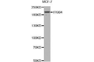 Western blot analysis of extracts of MCF7 cells lines, using ITGB4 antibody. (Integrin beta 4 anticorps  (AA 28-310))