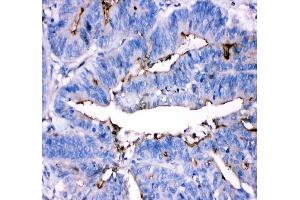IHC analysis of ADA using anti-ADA antibody (ABIN4886424). (ADA anticorps  (AA 135-363))