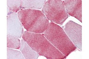 Anti-FABP3 antibody IHC of human skeletal muscle.