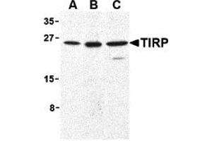 Western Blotting (WB) image for anti-Toll-Like Receptor Adaptor Molecule 2 (TICAM2) antibody (ABIN1030207)