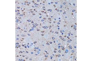 Immunohistochemistry of paraffin-embedded rat brain using IRAK4 antibody.