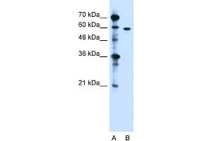 WB Suggested Anti-ZDHHC13 Antibody Titration:  1. (ZDHHC13 anticorps  (N-Term))