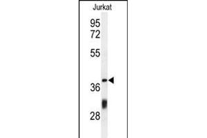Western blot analysis of C Antibody (Center) (ABIN650934 and ABIN2840000) in Jurkat cell line lysates (35 μg/lane). (CCDC130 anticorps  (AA 173-200))