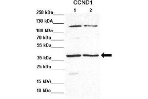 Lanes : Lane 1: 30ug PKO lysateLane 2: 30ug PKO + Doxor lysate  Primary Antibody Dilution :  1:1000   Secondary Antibody : Goat anti rabbit-HRP  Secondary Antibody Dilution :  1:5000  Gene Name : CCND1  Submitted by : Tobias Wagner, Institute for Biochemistry and Biophysics (Cyclin D1 anticorps  (Middle Region))