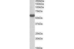 Western Blotting (WB) image for anti-Chromosome 22 Open Reading Frame 28 (C22orf28) (Internal Region) antibody (ABIN2464466) (C22orf28 anticorps  (Internal Region))