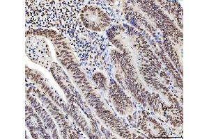 IHC analysis of C1orf77/FOP/CHTOP using anti-C1orf77/FOP/CHTOP antibody (ABIN7603201). (CHTOP anticorps  (N-Term))