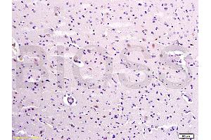 Formalin-fixed and paraffin embedded rat brain labeled with Anti-Caspase-9 Polyclonal Antibody, Unconjugated (ABIN724175) 1:300 followed by conjugation to the secondary antibody and DAB staining (Caspase 9 anticorps  (AA 271-314))