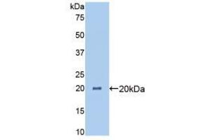 Western blot analysis of recombinant Pig ANGPTL4. (ANGPTL4 anticorps  (AA 227-389))