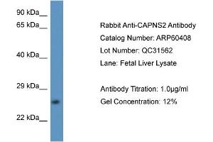 Western Blotting (WB) image for anti-Calpain, Small Subunit 2 (CAPNS2) (N-Term) antibody (ABIN2788439)
