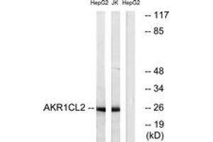 Western Blotting (WB) image for anti-Aldo-Keto Reductase Family 1, Member E2 (AKR1E2) (AA 141-190) antibody (ABIN2890107) (AKR1E2 anticorps  (AA 141-190))