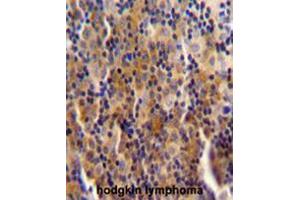anti-Chromosome 14 Open Reading Frame 49 (C14orf49) (AA 855-884), (C-Term) antibody