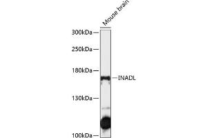 Western blot analysis of extracts of mouse brain, using INADL antibody (ABIN6134720, ABIN6142437, ABIN6142439 and ABIN6215633) at 1:1000 dilution.