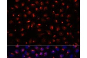 Immunofluorescence analysis of HeLa cells using ACTN3 Polyclonal Antibody at dilution of 1:100 (40x lens). (ACTN3 anticorps)
