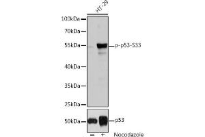 Western blot analysis of extracts of HT-29 cells, using Phospho-p53-S33 pAb (ABIN6135330, ABIN6136276, ABIN6136277 and ABIN6225656) at 1:2000 dilution or p53 antibody (ABIN3017540, ABIN3017541, ABIN3017542 and ABIN6220145). (p53 anticorps  (pSer33))